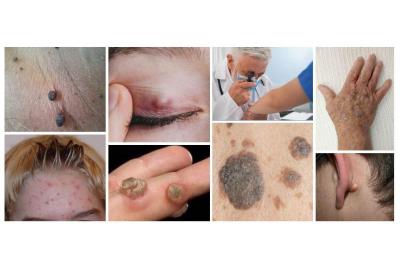 PCSA Publish New Patient Information Booklet